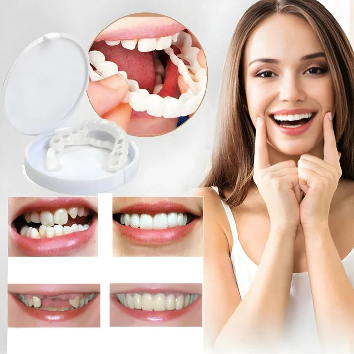 Instant Smile Snap-On Dental Veneers: Perfect Teeth Whitening & Correction Kit
