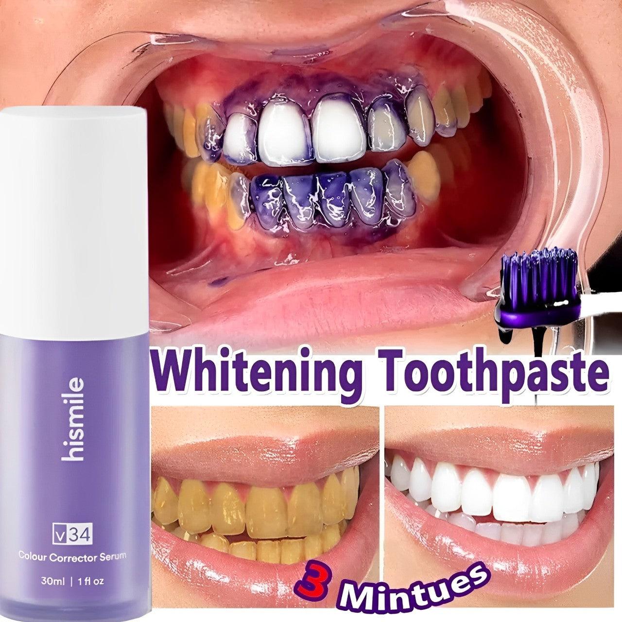 Hismile Advanced Purple Color Corrector Serum for Instant Teeth Whitening